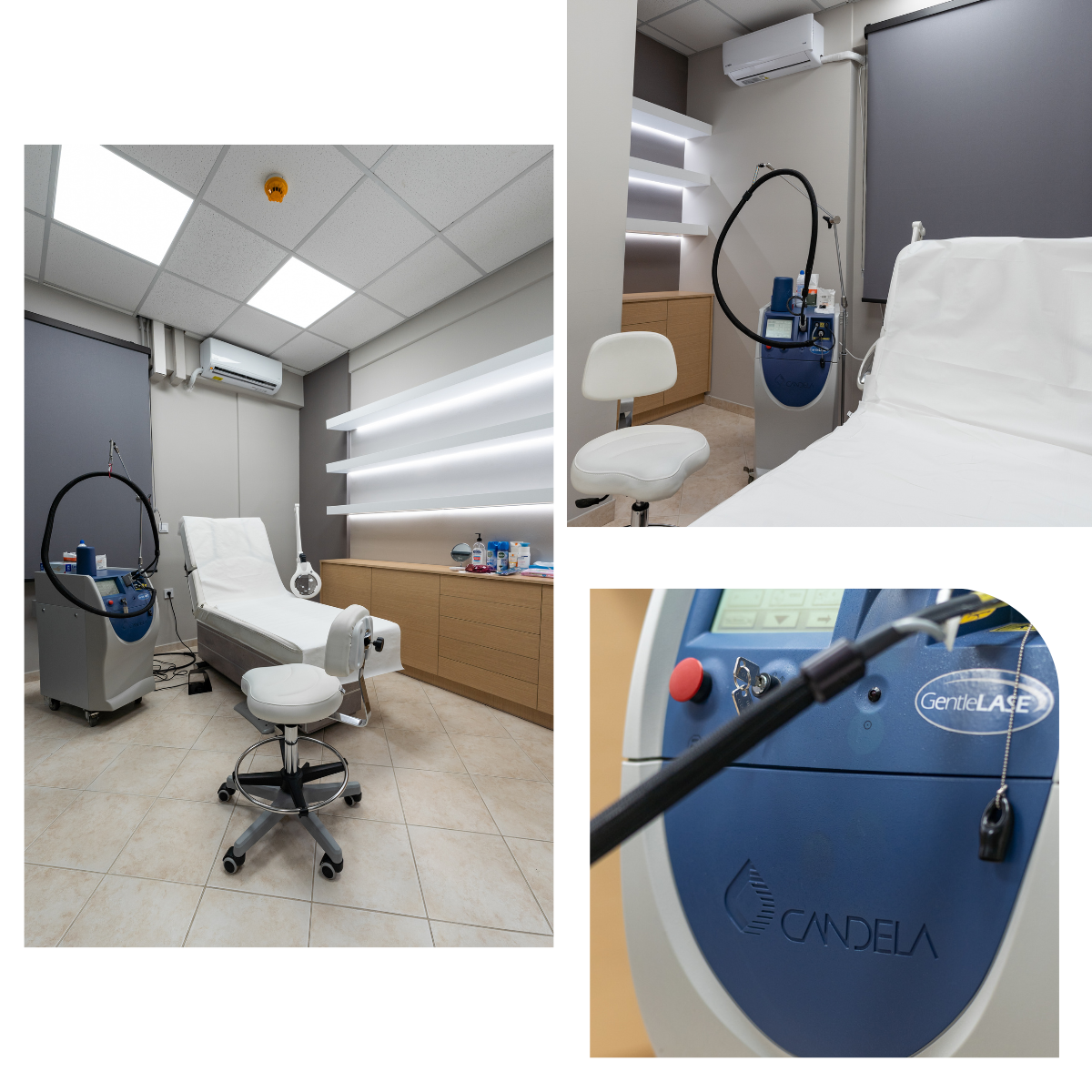 τι ειναι το laser